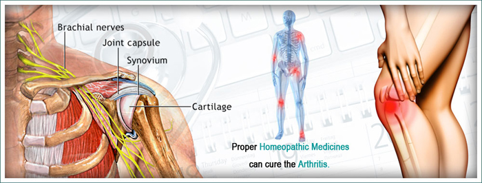 Osteoarthritis